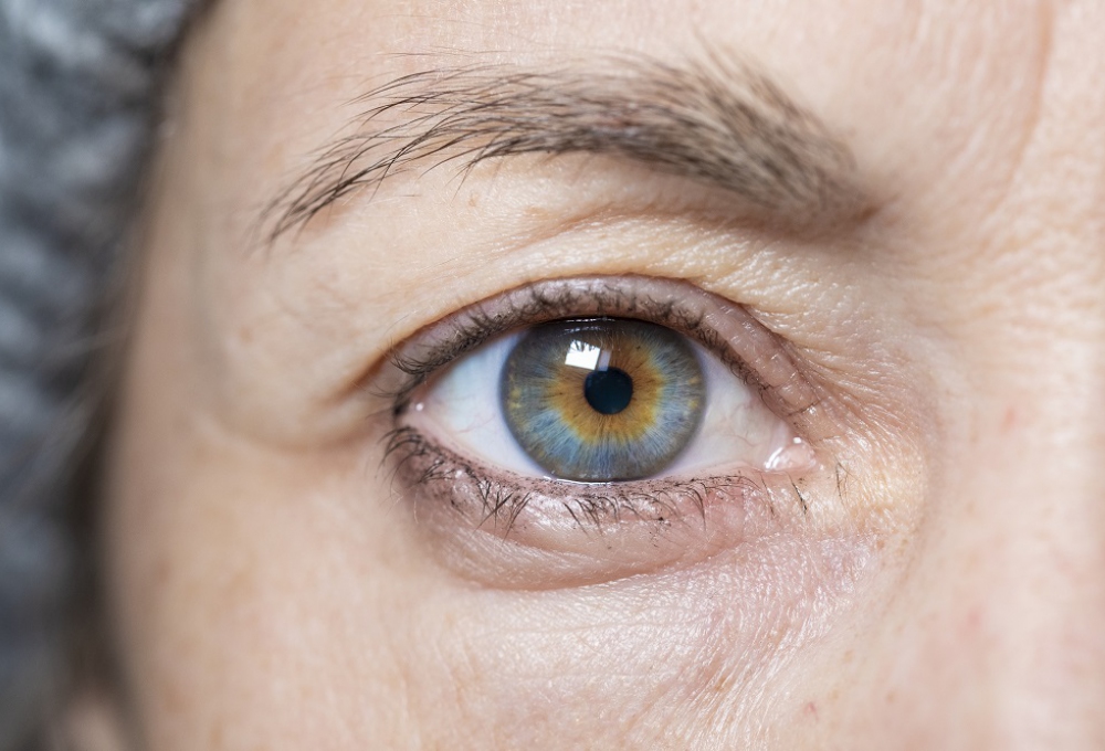 Ooglidcorrectiekosten.nl Ooglidcorrectiekosten.nl